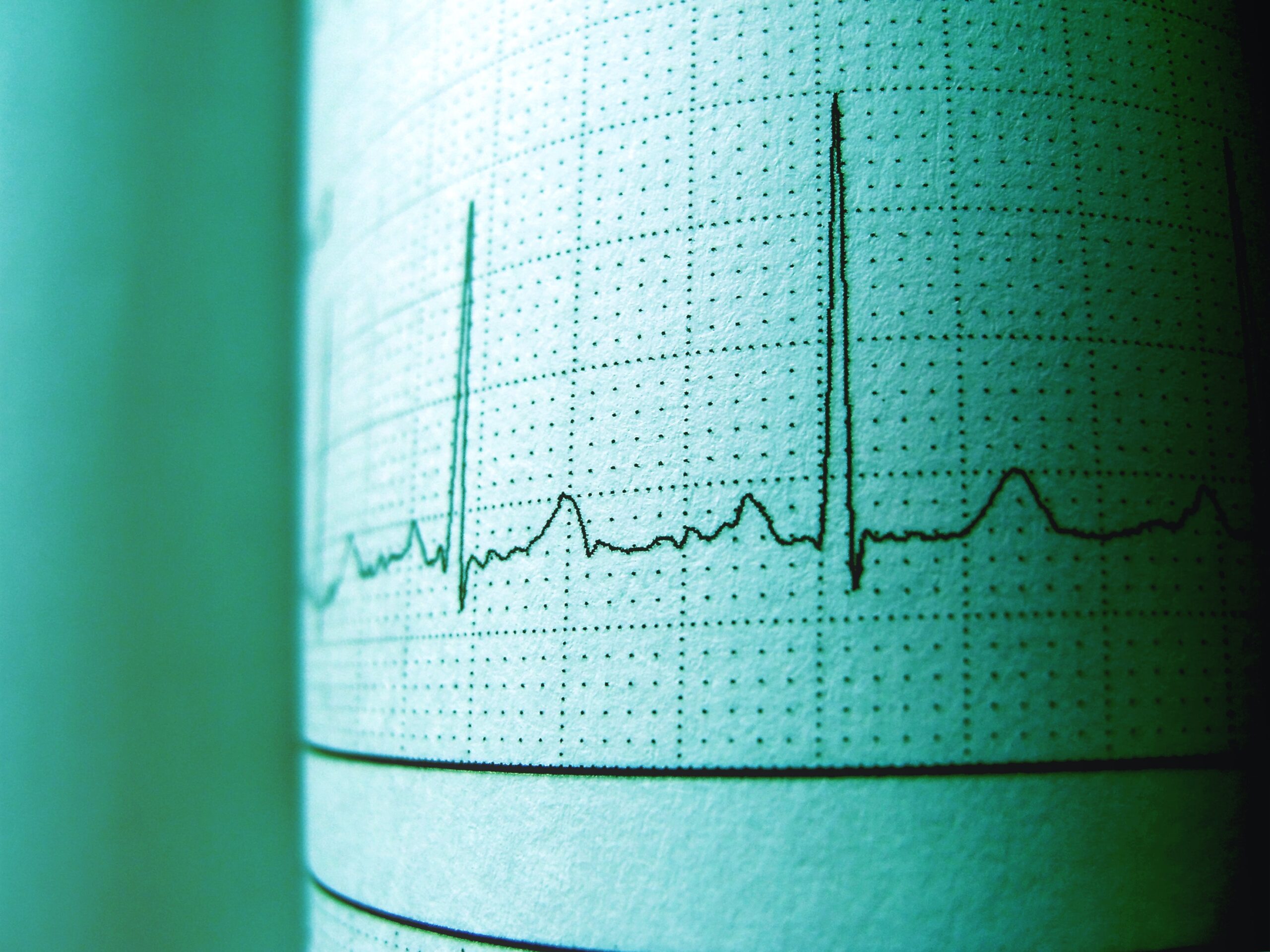 Electrocardiogram Cardioexpertisecentrum